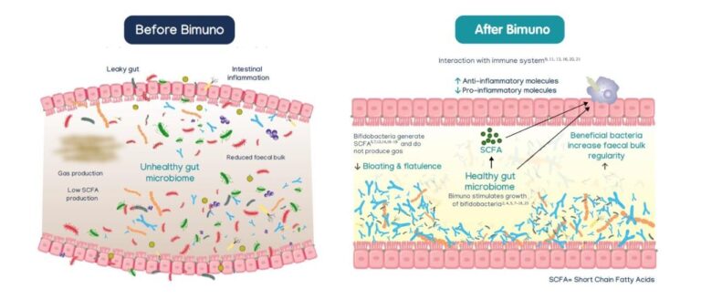 bimuno gos 2